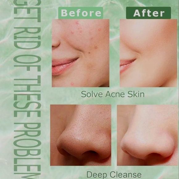 Kastu Green mask stick / New - Picture 5 of 8